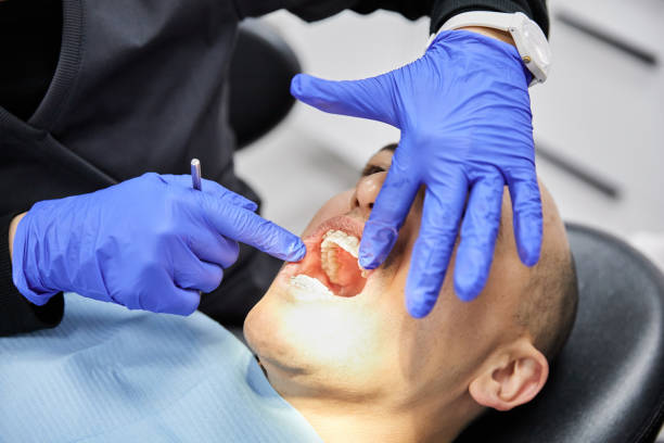 Best Emergency Care for Gum Disease in Porterdale, GA